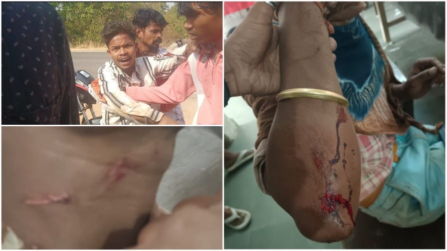 लैलूंगा में गुंडागर्दी का तांडव : महिलाओं के सम्मान में आवाज उठाना पड़ा भारी, दबंगों ने सरेराह भाइयों को लहूलुहान किया ; FIR दर्ज…